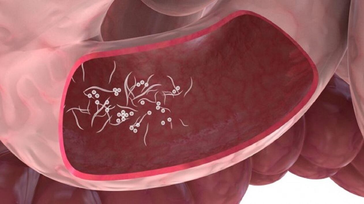 Giardia paraziti u jetri