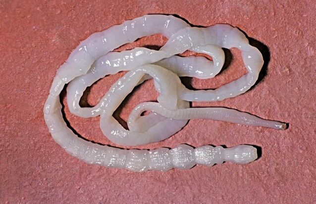 kako izgleda bikova trakavica