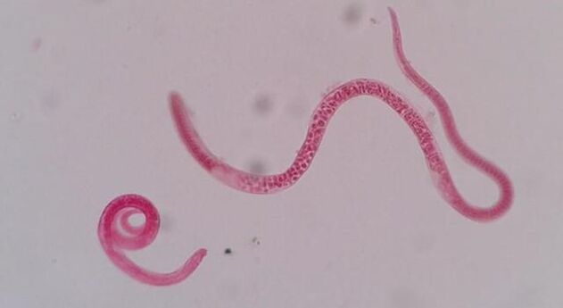 kako izgledaju trihinele