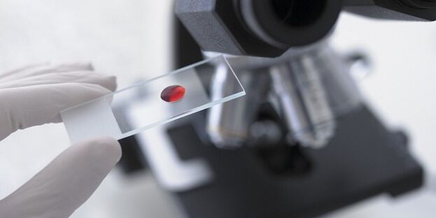 test krvi za dijagnosticiranje parazita u tijelu